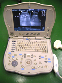 ポータブル超音波検査器